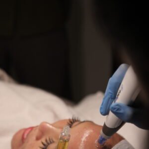 TREATMENT 4 Pendekatan Personalized di Maharis Clinic: Fokus pada Kebutuhan, Bukan Tren Semata